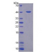 SDS-PAGE analysis of recombinant Human Aquaporin 4 Protein.