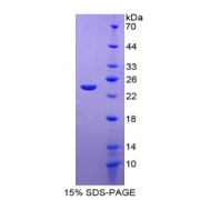 SDS-PAGE analysis of Junctional Adhesion Molecule 1 Protein.