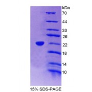 SDS-PAGE analysis of Neutrophil Specific Antigen 1 Protein.