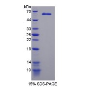 SDS-PAGE analysis of recombinant Human MAST2 Protein.