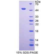 SDS-PAGE analysis of Neuroglobin Protein.