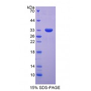 SDS-PAGE analysis of Signal Transducer And Activator Of Transcription 5B Protein.