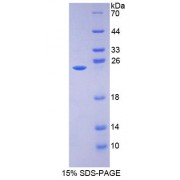 SDS-PAGE analysis of 17 beta Hydroxysteroid Dehydrogenase Type 10 Protein.