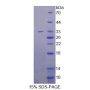 SDS-PAGE analysis of Meteorin Protein.