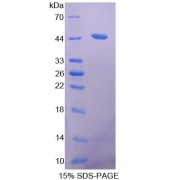 SDS-PAGE analysis of ACAT2 Protein.