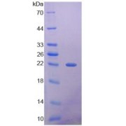 SDS-PAGE analysis of Histone Deacetylase 4 Protein.