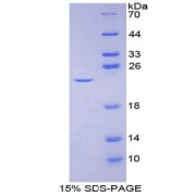 SDS-PAGE analysis of IL2 Protein.