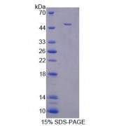 SDS-PAGE analysis of recombinant Mouse Interferon alpha 11 Protein.