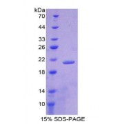 SDS-PAGE analysis of Lipocalin 1 Protein.