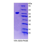 SDS-PAGE analysis of Apolipoprotein H Protein.