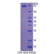 SDS-PAGE analysis of Angiostatin Protein.