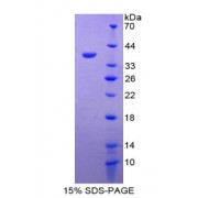 SDS-PAGE analysis of Metallothionein 1 Protein.
