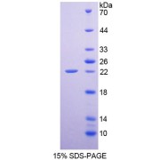 SDS-PAGE analysis of recombinant Rat Epiregulin Protein.