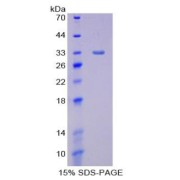 SDS-PAGE analysis of Lipase, Endothelial Protein.