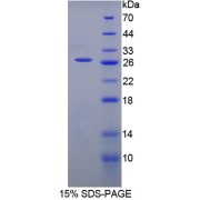 SDS-PAGE analysis of CRAT Protein.