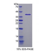 SDS-PAGE analysis of Intestinal Cell Kinase Protein.