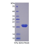SDS-PAGE analysis of AGER Protein.