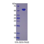 SDS-PAGE analysis of O-6-Methylguanine DNA Methyltransferase Protein.
