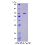 SDS-PAGE analysis of Smad6 Protein.