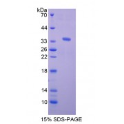 SDS-PAGE analysis of Complement Component 1, Q Receptor Protein.