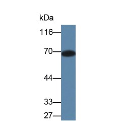 Human Advanced Glycation End Product (AGE) Protein
