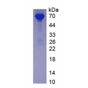 SDS-PAGE analysis of Albumin Protein.