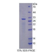 SDS-PAGE analysis of Myoglobin Protein.
