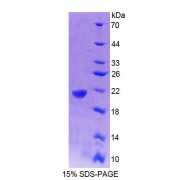 SDS-PAGE analysis of Rat GaA Protein.