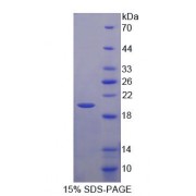 SDS-PAGE analysis of Human EP1 Protein.
