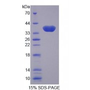 SDS-PAGE analysis of Pig GAL4 Protein.