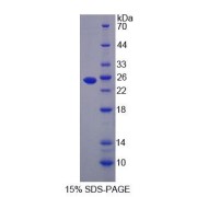 SDS-PAGE analysis of Human PSMB9 Protein.