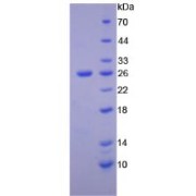 SDS-PAGE analysis of Human PTK7 Protein.