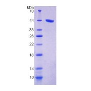 SDS-PAGE analysis of Human PKCd Protein.