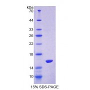 SDS-PAGE analysis of Mouse NT-ProANP Protein.