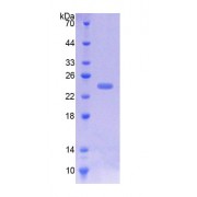 SDS-PAGE analysis of recombinant Pig ICAM1 Protein.
