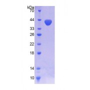 SDS-PAGE analysis of recombinant Human NOX5 Protein.