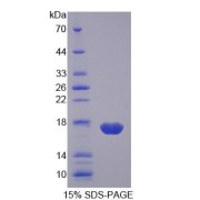 SDS-PAGE analysis of Pig FABP2 Protein.
