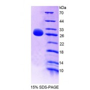 SDS-PAGE analysis of Rat GSTm4 Protein.