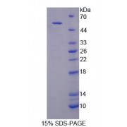 SDS-PAGE analysis of recombinant Rat GCK Protein.