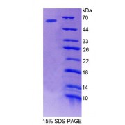 SDS-PAGE analysis of recombinant Human bACE1 Protein.