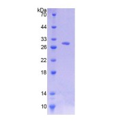 SDS-PAGE analysis of Human cADPRH Protein.