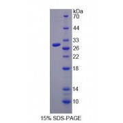 SDS-PAGE analysis of Human TLR4 Protein.