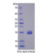 SDS-PAGE analysis of Human CFP Protein.