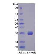 SDS-PAGE analysis of Human CFP Protein.