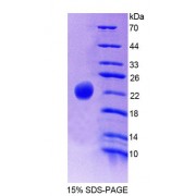 SDS-PAGE analysis of recombinant Rabbit Haptoglobin Beta Chain Protein.