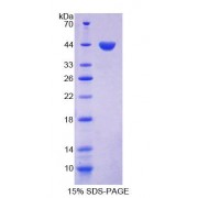 SDS-PAGE analysis of Human FSH Protein.