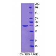 SDS-PAGE analysis of Human vWFCP Protein.