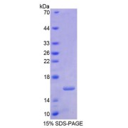 SDS-PAGE analysis of Human RARa Protein.