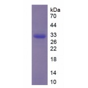 SDS-PAGE analysis of recombinant Human Cholinergic Receptor_ Nicotinic_ Alpha 1 CHRNa1 Protein.