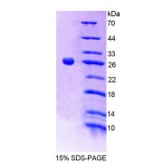 SDS-PAGE analysis of Mouse CNTN2 Protein.